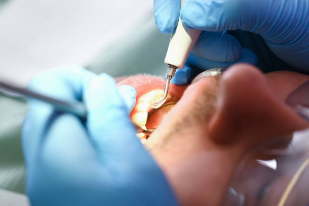 Best Emergency Root Canal Therapy in Middletown, PA